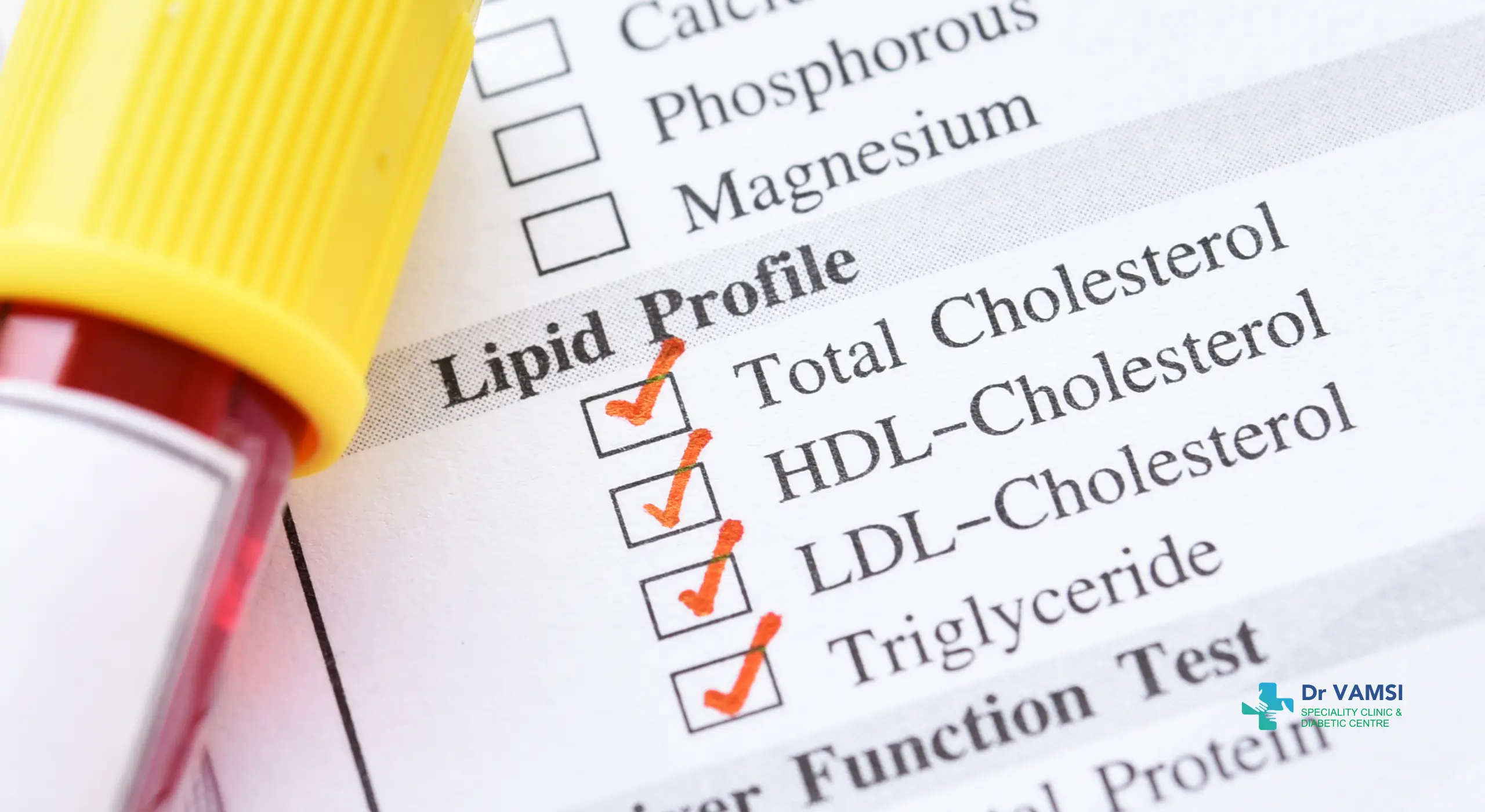 Cholesterol Explained_ Good, Bad, Triglycerides Guide