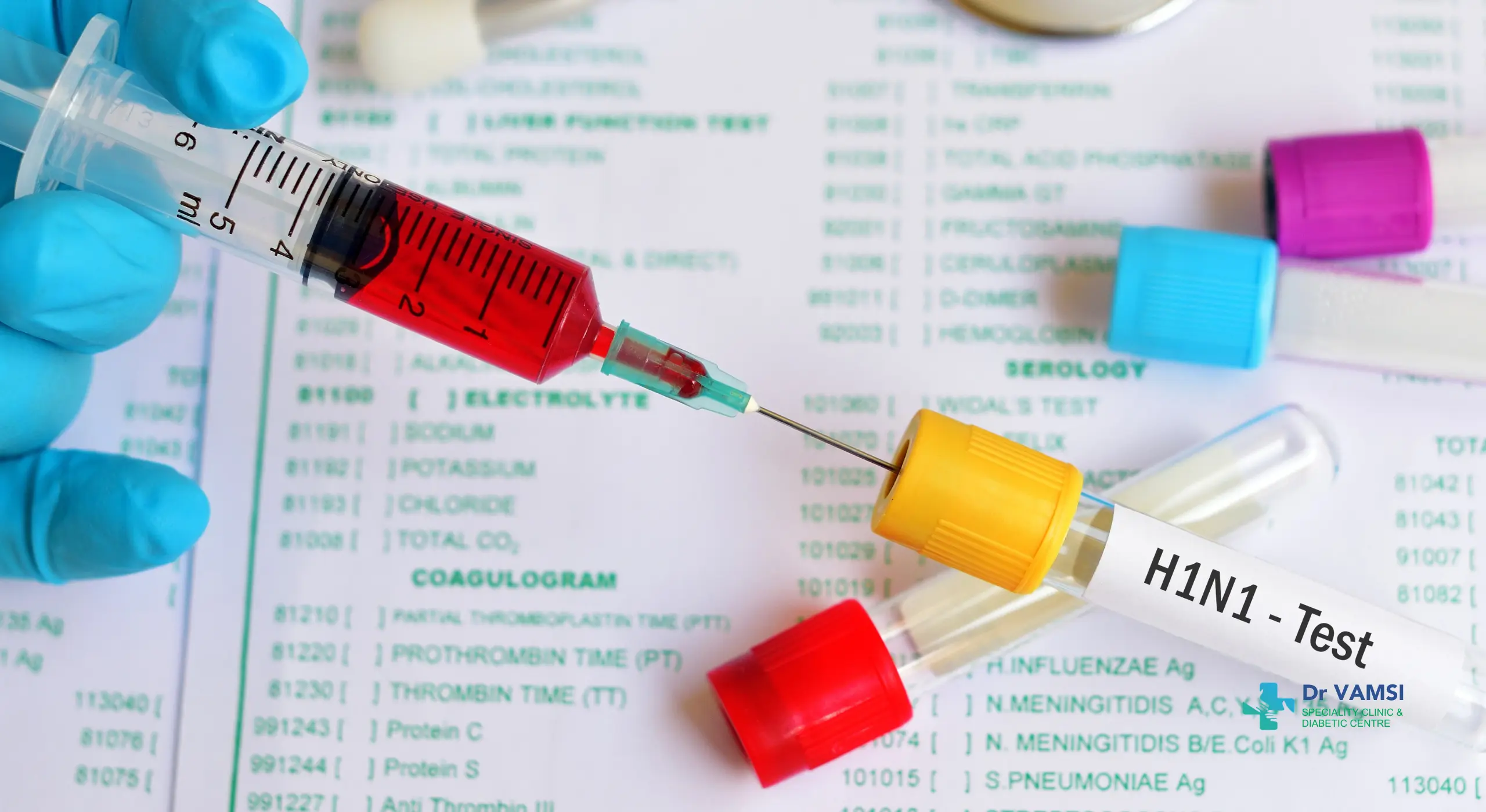 H1N1 symptoms in Bangalore
